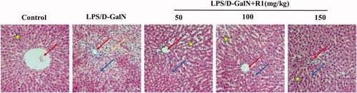 Figure 4. The effect of R1 protein components on the pathological changes of liver tissue. The pictures are taken from the representative histological changes of the livers of different groups of mice. Comments: central vein (red arrow), inflammatory cells (blue arrow), cellular necrosis (yellow arrow) and hepatocyte cord (pentagram).