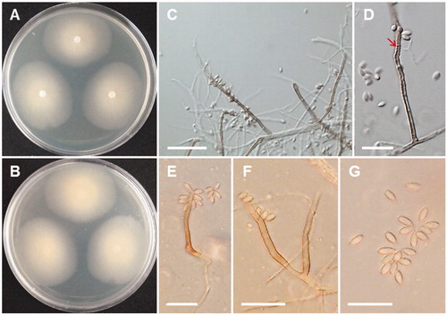 Figure 8. Morphology of Myrmecridium schulzeri CNUFC-NDR5-2. A, B, Colony on malt extract agar; C–F, Conidia and conidiophores (D, rachis with scattered, pimple-shaped denticles (red arrow); F, Branched conidiophores); G, Conidia (Scale bars: C = 40 μm, D–G = 20 μm).