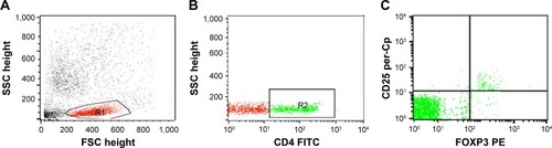 Figure 1 Flow cytometry detection of regulatory T (Treg) cells.Notes: (A) Forward and side scatter histogram depicting lymphocyte population (R1). (B) The expression of CD4 was assessed in the lymphocyte population (R1) and CD4+ T cells were gated. (C) Then, the expression of CD25 and FOXP3+ cells on CD4+ T cells was assessed to detect CD4+CD25+FOXP3+ Treg cells.Abbreviations: SSC, side scatter; FSC, forward scatter; FITC, fluorescein isothiocyanate.