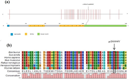 Figure 2. Bioinformatics analysis of the identified missense variant of LAMC1. (a) The location of the variant in the intron-exon structure of LAMC1 and the protein domain map of LAMC1. The missense variant (c.3281A > T, p.D1094V) of LAMC1 is located in the domain I and II. (b) Amino acid alignment of the LAMC1 protein from several organisms. The position of Asp1094 residue (highlighted by a black box) was highly conserved among different species.