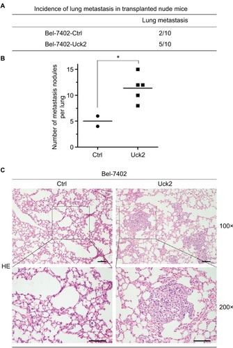 Figure 4 Uck2 promotes metastasis in HCC cells in vivo.Notes: (A) Incidence of lung metastasis in transplanted nude mice 8 weeks after the injection of Bel-7402-Uck2 cells or control cells into the tail vein. (B) The number of metastatic lung foci observed in each group. *P-value <0.05. (C) Representative H&E staining images of lung tissue samples from the different experimental groups (scale bar, 100 µm).Abbreviations: HCC, hepatocellular carcinoma; Uck2, uridine-cytidine kinase 2.