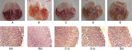 Figure 3.  Histological evaluation of antiulcer activity of chloroform extract of B. purpurea (CEBP) against absolute ethanol-induced gastric lesions in rats (A) Stomach of an ulcer control rat; (B) Stomach of a rat pre-treated with omeprazole; (C) Stomach of a rat pre- treated with 100 mg/kg CEBP; (D) Stomach of a rat pre-treated with 500 mg/kg CEBP; (E) Stomach of a rat pre- treated with 1000 mg/kg CEBP; The respective histopathological sections are shown below; (Ai) Stomach of the ulcer control animal showing mild effect on mucosa and moderate hemorrhagic erosion, severe edema, mild infiltrate leukocytes and presence of mild inflammatory exudates; (Bi) Stomach of omeprazole treated animals show moderate effect on mucosa with moderate hemorrhage and edema; (Ci) Stomach of 100 mg/kg CEBP treated animals showing mild effect on mucosa with moderate effect on edema and presence of inflammatory exudates; (Di)Stomach of 500 mg/kg CEBP treated animals showing almost normal mucosa with moderate effect of edema and mild presence of inflammatory exudates and leukocytes infiltrate; (Ei) Stomach of 1000 mg/kg CEBP treated animals showing almost normal mucosa with moderate effect edema and presence of inflammatory exudates