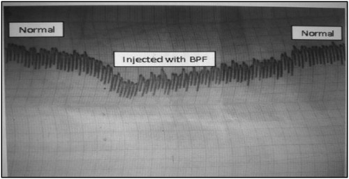 Figure 2. An oscillograph changes initiated in a rabbit atrium contraction by the isolated BPF as indicator for hypotensive effect.
