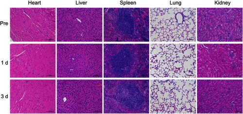 Figure 7 HE staining of heart, liver, spleen, lung and kidney samples before,1 d and 3 d after injection of Gd@Cy5.5@SiO2-PEG-Ab NPs.