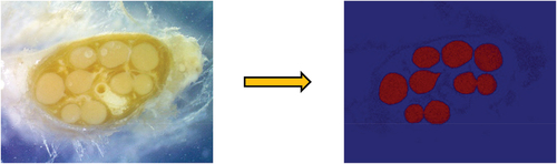 Figure 3. Raw microscopic image (left) that was used for training is plugged back into the prediction model which generates a semantic segmentation with an approximately 91% accuracy rate (right).