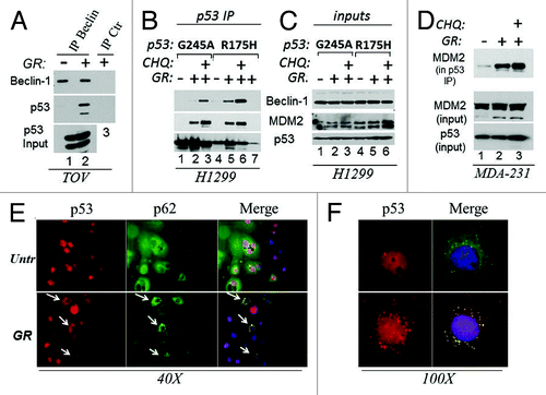 Figure 3. GR promotes the interaction of mutant p53 with the autophagic machinery and with MDM2. (A) Cell extracts prepared from untreated or GR-treated TOV cells for 4 h (approximately 5 mg) were immunoprecipitated with the anti-Beclin-1 monoclonal antibody, followed by immunoblot with the anti-p53 (FL393) or anti-Beclin polyclonal (lanes 1 and 2). Similar amounts of cell extracts derived from GR-treated cells were immunoprecipitated with control isotope matched antibody (indicated as IP ctr. lane 3). The bottom panel shows input levels of p53. (B) H1299 cells expressing p53G245A (lanes 1–3) or R175H (lanes 4–7) under the control of a tetracycline inducible promoter were induced with doxycycline for 12 h, then grown in regular media (lanes 1 and 4) or in GR media in the absence (lanes 2, 5 and 7) or presence of chloroquine (CHQ, lanes 3 and 6) for 4 h. Cell extracts (0.5–1 mg) were immunoprecipitated with agarose conjugated anti-p53 antibody, then probed in immunoblot with anti-Beclin-1, anti -MDM2 or anti-p53 antibodies. Lane 7 contains a control immunoprecipitation from p53R175H cell extracts with an isotype matched antibody. A small amount of p53 is detected in this control IP. (C) Input levels of the proteins as in (B) (20 μg). (D) Cell extracts derived from MDA-231 cells untreated (lane 1) or GR-treated (lanes 2 and 3) for 4 h, in the absence (lanes 1 and 2) or presence of CHQ (40 μM, lane 3) were immunoprecipitated with the agarose conjugated FL393 antibody and probed with the MDM2 monoclonal antibody. The panel shows MDM2 in the p53 IP, and input levels of MDM2 or p53. (E) BT20 cells plated on glass coverslips were grown in regular (Unt) or GR media for 16 h, subsequently stained with anti-p53 (red) or anti-p62 (green) antibodies and immunofluorescence images were captured at 40x magnification. The merge images show the red and green channels merged with DAPI. Arrows indicate cells were p62 and p53 co-localize in the cytoplasm. (F) Shows a 100x magnification of p53 staining in untreated or GR-treated cells (red), and the merged image with p62 and DAPI. Note the strong punctate pattern of p53 staining in GR-treated cells. These experiments are quantified in Fig. S1B.