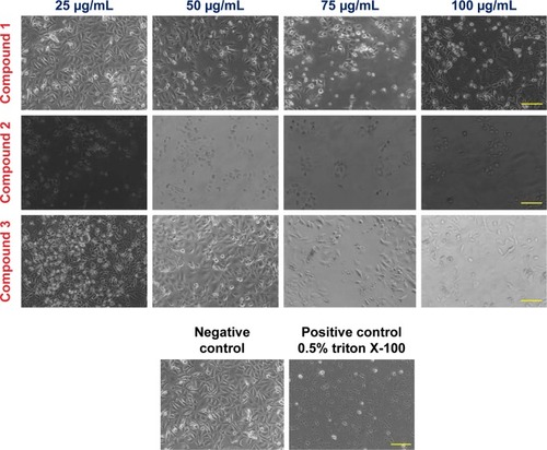 Figure 2 Induction of AGS cell death by compounds 1, 2, and 3 after 48 h of incubation with different concentrations (25, 50, 75, and 100 μg/mL) at 37°C in an atmosphere of 5% CO2.