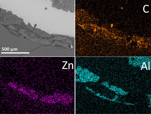 Figure 9. The SEM/EDS mapping images taken on the sample e after 6 years in vivo aging when resin composite cement and zinc phosphate cement were used for lining and for luting, respectively. The strong element contrast of aluminium and zinc detected in different regions confirmed the use of a zinc phosphate cement and a resin composite cement containing alumina and silica fillers. The detected carbon content inside the zinc phosphate cement indicated the contamination of the zinc phosphate cement by saliva/ oral fluid via the formed interfacial gap.