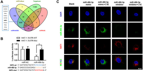 Figure 4 Regulatory interactions between miR-486-5p and HAT1. (A) Venn diagram of the predicted miR-486-5p targets in four databases. Results of the luciferase reporter assays (B) and fluorescence in situ hybridization (C) showing that miR-486-5p regulates the target HAT1. *P < 0.05.
