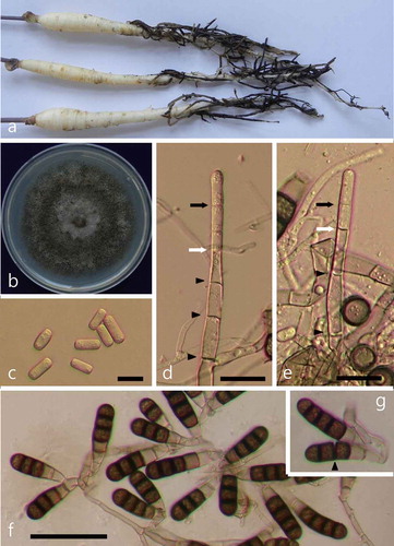 Fig. 1 (Colour online) Symptoms of black root rot on Korean ginseng seedlings and morphological features of the pathogenic fungus T. basicola. (a) Symptoms of black root rot. (b) A fungal colony on PDA after 15 days of incubation. (c) Single-celled hyaline endospores (bar = 10 μm). (d–e) Production of endospores deep within the phialide (bar = 20 μm). The youngest septum in the process of formation (white arrow) and the tip of the phialide wall (black arrow) are indicated. Protoplasmic continuities across septa are shown by black arrowheads. (f) Numerous dark aleuriospores (bar = 50 μm). (g) Aleuriospore breaking up into individual spores (arrowhead).