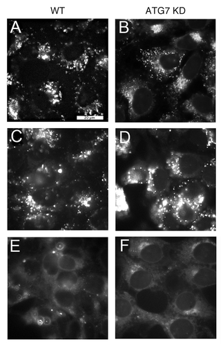 Figure 2. Subcellular localization of WST11 and effects on LTR fluorescence. Fluorescence localization patterns of WST11 in WT (A) or ATG7 KD (B) cultures after a 16 h incubation with 1 μM drug. (C–F) Effects of photodamage on the pattern of LTR fluorescence. Wild-type (C and E) or ATG7 KD cultures (D and F) were photosensitized with 1 μM WST11 for 16 h, then treated with LTR for 10 min before (C and D) or directly after (E and F) irradiation (90 mJ/cm2). White bar in (A): 20 μm. Photographs are representative of observations for three independent experiments.