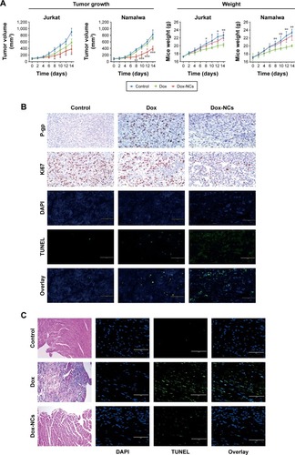 Figure 5 In vivo effects of Dox-NCs in murine lymphoma xenograft models.Notes: (A) In both T- and B-cell lymphoma xenograft models, intraperitoneal treatment of Dox-NCs significantly inhibited tumor growth without affecting the weight of the mice. *P<0.05, **P<0.01, ***P<0.001 compared with Dox. (B) As compared with the Dox group, decreased proliferative index Ki67 and low expression of P-pg were observed in the tumors of the Dox-NC group. TUNEL assay showed that Dox-NCs enhanced tumor apoptosis significantly. Scale bar set at 100 µm. (C) Hematoxylin-eosin staining and TUNEL assay revealed diminished apoptosis of cardiac cells by Dox-NCs in vivo. Scale bar set as 100 µm (D) Dox-NCs induced cellular apoptosis to a lesser degree in cardiac cell line H9C2 than Dox. ***P<0.0001 compared with Dox. Scale bar set as 100 µm. (E) Dox-loaded dextran-based NCs are an efficient drug delivery system to treat malignant lymphoma with less cardiac toxicities.Abbreviations: Dox, doxorubicin; h, hours; NCs, nano-carriers; TUNEL, terminal deoxytransferase-catalyzed DNA-nick-end labeling assay.