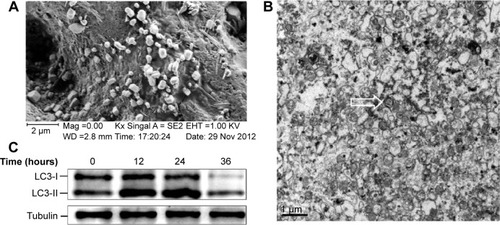 Figure 1 Ultrastructure and surface morphology of DRibbles.Notes: DRibbles were induced from the SCC7 cell line by rapamycin (100 nM), bortezomib (100 nM), and ammonium chloride (10 mM) for 24 hours. (A) A scanning electron micrograph of DRibbles harvested from SCC7 cells. The diameters of these particles with a relatively smooth surface and spherical structure were in the ranges of 200–500 nm. (B) A transmission electron micrograph of DRibbles. Numerous vesicles with double-membrane structure huddled together, and their dimensions also ranged between 200 nm and 500 nm. The arrow shows autophagosome with the typical double-membrane structure containing undegraded cellular materials. (C) Autophagosomal marker LC3 detected by Western blot analysis. SCC7 cells were treated with 100 nM rapamycin, 100 nM bortezomib, and 10 mM ammonium chloride in complete medium for 12, 24, and 36 hours, respectively. Meanwhile, the untreated SCC7 cells served as control. Cell lysates were prepared from each group. Total proteins were loaded on 4%–12% SDS-PAGE gels and stained with rabbit anti-LC3 antibody for Western blot analysis. LC3-I to LC3-II conversion of SCC7 cells markedly increased after the treatment of rapamycin, bortezomib, and ammonium chloride in a time-dependent manner.Abbreviations: DRibbles, tumor-derived autophagosomes; SDS-PAGE, sodium dodecyl sulfate polyacrylamide gel electrophoresis.