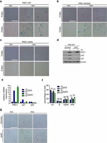 Figure 6. Expression of PRC1 results in p53-dependent senescence but not in apoptosis A) -C) Expression of PRC1-WT (A), PRC1-NLS3A (B) or PRC1-∆N78 (D) was induced for 4 days or 8 days and senescent cells were detected by staining for ß-galactosidase. Bar: 100 μm. D) and E) Immunoblot and RT-qPCR analysis of p53 and p21 in cells transfected with a siRNA specific for p53 or with a control siRNA transfection and after induction of PRC1 with doxycycline. F) Flow cytometry analysis of the fraction of cells in different cell cycle phases. n = 3 biological replicates. **p < 0.001; ***p < 0.0001; ns: not significant. G) Cells were treated as in D. Senescent cells were detected by staining for ß-galactosidase. Bar: 200 μm.