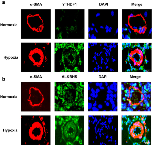 Figure 7. Immunofluorescence staining of YTHDF1 (a), IGF2BP1 (b), ALKBH5 (c) in pulmonary vessels. α-SMA (red), objective protein (green) and nucleus were dyed with DAPI (blue), scale bar = 40 μm.