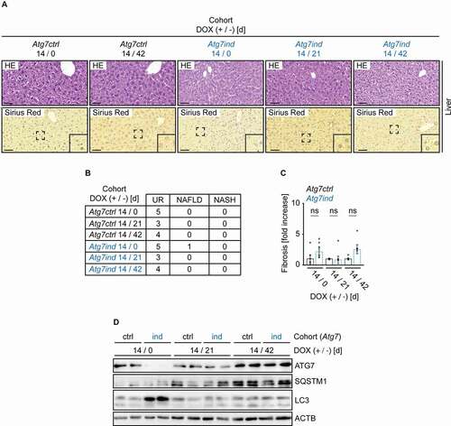 Figure 7. NASH and fibrosis do not occur after 14 d induction of Atg7-shRNA mice. (A) Representative images of liver tissue from all cohorts stained as indicated. Scale bars: 20 µm. Inserts are higher magnifications of the boxed area. (B) Number of mice with unremarkable livers (UR), livers with histological evidence of nonalcoholic fatty liver disease (NAFLD) and nonalcoholic steatohepatitis (NASH) in the indicated cohorts. (C) Quantification of fibrosis. Statistics: Welch’s t-test (n from left to right: 5, 6, 3, 5, 4, 4). ns: not significant. (D) Western blots as indicated to validate target knockdown and its effect on SQSTM1 protein expression and LC3 levels.