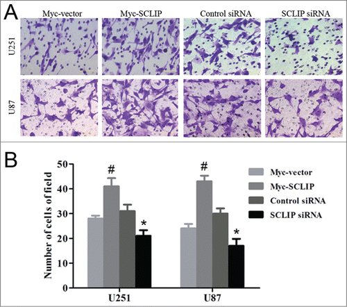 Figure 6. SCLIP induces invasion of U251 and U87 cells. (A) Images of indicated cell lines were taken from the Matrigel invasion assay. (B) Quantification of indicated invasive cells from 3 independent experiments. Myc-SCLIP vs. Myc-vector, #P<0.01; SCLIPsiRNA vs. Control siRNA, *P<0.05.