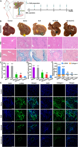 Figure 5 Efficacy of nanosuspensions against bile duct ligation (BDL)-induced hepatic fibrosis in mice. (A) Schematic of therapeutic schedule. (B) Appearance and histological analysis of liver tissues after 3 weeks of treatment with different formulations. Scale bar, 100 μm. (C and D) Levels of (C) alanine aminotransferase (ALT) and (D) aspartate aminotransferase (AST) after 3 weeks of treatment. (E) Immunofluorescence staining of liver sections against α-smooth muscle actin (α-SMA) or collagen I with Alexa Fluor® 488-labeled IgG (green) after 3 weeks of treatment. Cell nuclei were stained with DAPI (blue). Scale bar, 50 μm. (F) Semi-quantitative analysis of immunofluorescence images. Normal mice were used as controls. Data are shown as mean ± SD (n = 5). ****P < 0.0001; ***P < 0.001; *P < 0.05; ns, non-significant difference vs control.