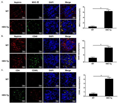 Figure 3. Upregulated MHC-II and CD40 expression in the podocytes of HBV-Tg mice, and infiltrated CD4+ T cells exhibited increased CD40L expression in the glomeruli. Scale bar: 15 μm. (A-C) Immunofluorescence for MHC-II (a), CD40 (B), CD4 and CD40L (C) in WT and HBV-Tg mice. Analysis of mean optical density in each group. Data are presented as the mean ± SD. *p < 0.05.