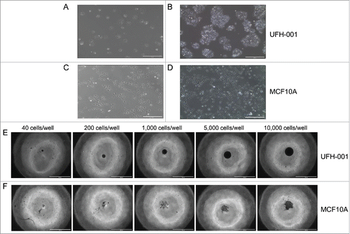 Figure 3. Morphology and spheroid formation of the UFH-001 and MCF10A cells. UFH-001 cells showed a cohesive cobblestone morphology and formed colonies at low (Panel A) and high (Panel B) density (see Methods and Material for details). MCF10A cells displayed an elongated and spindle-like appearance at low (Panel C) and high (Panel D) density. Magnification: 10X, scale bar: 400μM. UFH-001 cells formed circular and dense spheroids across all starting concentrations at 48 h (Panel E). MCF10A cells formed irregular spheroids and only at starting densities of 5,000 and 10,000 cells/well at 48 h (Panel F). The scale bar represents 1 mm. Magnification is 4X.
