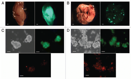 Figure 3 PKH26Hi osteosarcoma cells are more tumorigenic and generate bone tumors and lung metastasis. (A) Bone tumor (bright, left; ZsGreen, right) obtained after orthotopic injection of 1000 PKH26Hi cells. Bar 1 mm. (B) Pulmonary metastasis (bright, left; ZsGreen, right) are observed in some bone tumor bearing mice. Bar 1 mm. (C) sarcospheres obtained from bone tumors demonstrate the presence of PKH26 dye (bright, left; ZsGreen, right; PKH26, bottom) Bar 50 µm. (D) sarcospheres generated from pulmonary metastasis appeared to have an increased proportion of PKH26 cells (bright, left; ZsGreen, right; PKH26, bottom) Bar 50 µm.