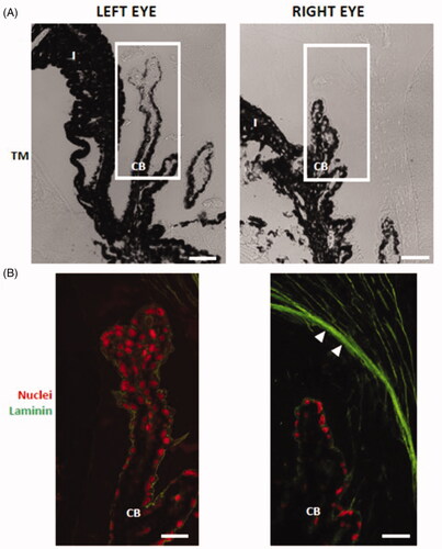 Figure 11. Laminin deposition in the zonular fibers (arrowheads) of dexamethasone-injected rat eyes. The ciliary body in (A) transmission mode (TM) and (B) in fluorescence. RE: right eye (injected with dexamethasone-loaded microspheres); LE: left eye; CB: ciliary body; non-PE: non-pigmented epithelium; PE: pigmented epithelium. Scale bars: (A) 43.48 μm; (B) 20.60 μm.