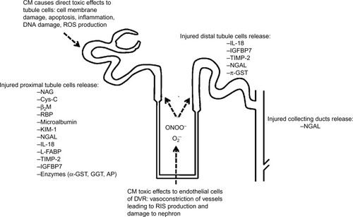 Figure 1 Illustration of toxicity caused by CM in the nephron and sites of origin of biomarkers.
