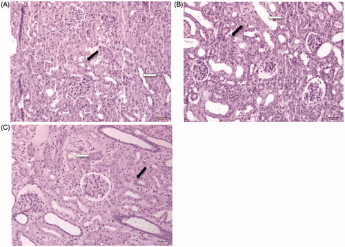 Figure 4. Postoperative kidney sections with hematoxylin and eosin (HE) staining. The hollow arrows represent the renal tubules. The solid arrows represent the renal interstitial. (A) HE for kidney in sham control group on the 10th day (200× folds). (B) HE staining for kidney in PUUO group on the 10th day (200× folds). Renal interstitial broadening and dilated tubules. (C) HE for kidney in RUUO group on the 20th day after relief (200× folds). Renal interstitial and tubules partially recovered.