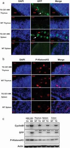 Figure 5. G2/M phase fluorescent sensor expression in adult tissues of knock-in transgenic mouse. (a), Cryosections of thymus and spleen from adult transgenic mouse CE1-MK and wild type mouse were stained with DAPI. Some cells in CE1-MK mouse section are EGFP positive showing the cells in mitosis, while wild type mouse sections as the control have not any EGFP positive signal. (b), Cryosections of thymus and spleen from adult transgenic mouse CE1-MK and wild-type mouse were stained with antibody against P-Histone H3 (Ser10). Some cells in CE1-MK mouse and control wild-type mouse sections are P-Histone H3 positive showing the cells in mitosis. C, Western-blot result showed that P-Histone H3 expressed in adult mouse thymus, spleen and colon tissue. The protein levels of cyclin B1 and EGFP were detected in CE1-MK transgenic and wild type control mice. The expression of cyclin B1 is increased in CE1-MK mice and the EGFP is only expressed in transgenic mice. Actin was detected as the loading control of western-blot.