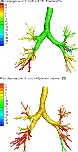 Figure 3 Changes in iRaw after 3 months of treatment with NAC (top) and placebo (bottom) in an iRaw nonresponder.