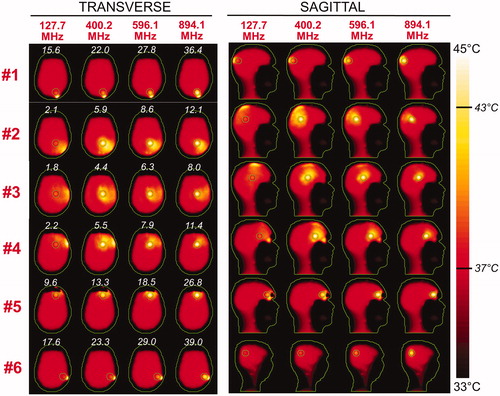 Figure 7. Temperature maps associated with the uSAF HT treatment for tumours #3–#6 and frequencies 127.7, 400.2, 596.1 and 894.1 MHz. The slices shown are transverse and sagittal views of the temperature volume though the centre of the tumours. Input SAR maps are scaled so as to achieve a maximum temperature of 45 degrees at the end of the 30-min HT treatment. Note that the maximum temperature is not necessarily achieved inside the tumour. Contours of the head and the target tumour ROI are shown in green. The white numbers indicate the temperature amplification ratio, which is the ratio of the average temperature increase inside and outside the tumour. Temperature amplification ratios are computed for the whole head and are, therefore, the same for the transverse and sagittal views.