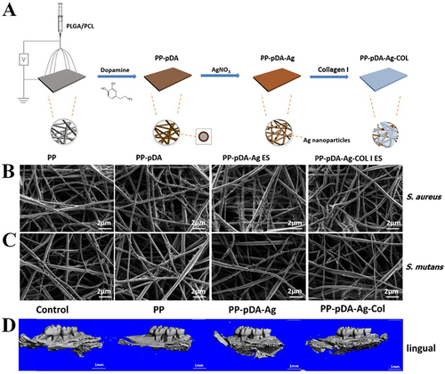 Figure 9 (A) Schematic illustration of the preparation procedure of PP-pDA-Ag-COL scaffolds. Surface topography the PP-pDA, PP-pDA-Ag, and PP-pDA-Ag-COL scaffolds incubated with S. aureus (B), S. mutans (C) were observed by FESEM. Scale bars = 2 μm. (D) μCT 3D reconstruction of the left maxillary mouse molars after 6 week implantation of PP, PP-pDA-Ag, and PP-pDA-Ag-COL scaffolds. The periodontitis mouse model is the control. Reprinted with permission from Qian Y, Zhou X, Zhang F, et al. Triple PLGA/PCL scaffold modification including silver impregnation, collagen coating, and electrospinning significantly improve biocompatibility, antimicrobial, and osteogenic properties for orofacial tissue regeneration. ACS Appl Mater Interfaces. 2019;11:37381–37396. doi:10.1021/acsami.9b07053. Copyright 2019, American Chemical Society.Citation91