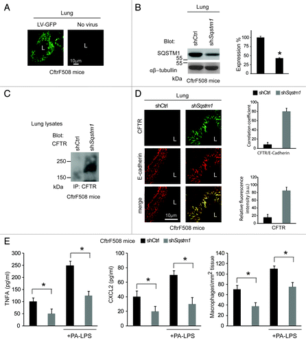 Figure 3. Direct Sqstm1 depletion ameliorates either constitutive or LPS-triggered lung inflammation in vivo in CftrF508del homozygous mice. (A) GFP expression in airway tissues from CftrF508del mice after intranasal transduction of a lentiviral vector expressing the GFP (LV-GFP). L, Lumen. Scale bar: 10 μm. (B) Immunoblot and densitometric analysis of SQSTM1 in lungs of CftrF508del mice 4 d after intranasal transduction with a lentiviral vector encoding shSqstm1 or no target sequence (shCtrl) (n = 5 for each group; *p < 0.01; ANOVA). (C) Immunoblot of CFTR (clone CF3) after immunoprecipitation of whole lung lysates with anti-CFTR antibody (clone H182). (D) Left, confocal microscopy images of CFTR (clone H182) and E-cadherin in lung tissues from mice treated as in (B). L, Lumen. Scale bar: 10 μm. Right, relative fluorescence intensity and coefficient of co-localization. (E) ELISA detection of TNFA and CXCL2 protein levels in lung homogenates (left and middle) and number of CD68+ macrophages (per mm2 of lung tissue) counted in 15–20 different random selected fields per lung per mouse for each experimental group (right) in the absence or presence of PA-LPS challenge. Mean ± SD of triplicates for each experiment. *p < 0.01 vs shControl (shCtrl) (ANOVA).