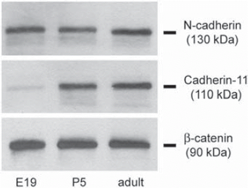 Figure 3. Representative Western blots for N-cadherin, cadherin-11, and β-catenin in developing rat hippocampus (n = 3). Whereas N-cadherin and β-catenin protein content were similar at all stages of hippocampal development investigated, cadherin-11 content was very low at the embryonic stage.