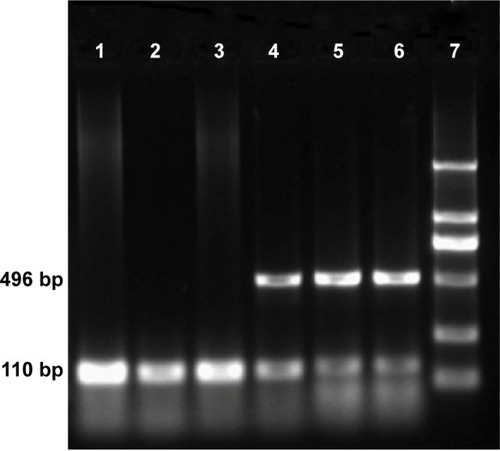 Figure 7 Gel electrophoresis of HSV-TK amplified by RT-PCR after pHsp 70-HSV-TK transfected into SMMC-7721 cells.Notes: Lane 1, the thermotherapy-alone group with only one strip, 110 bp of GAPDH; lane 2, the gene transfection-alone group with only one strip, 110 bp of GAPDH; lane 3, the blank control group with only one strip, 110 bp of GAPDH; lanes 4–6, gene therapy combined with heating therapy group with two clear strips, 496 bp of HSV-TK and 110 bp of GAPDH used as reference gene; lane 7, marker (each band in turn from bottom to top is 100, 300, 500, 750, 1,000, and 2,000 bp).Abbreviations: bp, base pair; GAPDH, glyceraldehyde 3-phosphate dehydrogenase; HSV-TK, herpes simplex virus thymidine kinase; RT-PCR, reverse transcription-polymerase chain reaction.