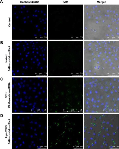 Figure 8 Confocal images of blank control (A), cells treated with naked FAM-survivin-siRNA (B), GRH/FAM-survivin-siRNA (C) and Lipo™ 2000/FAM-survivin-siRNA (D).