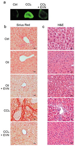 Figure 3. Suppression by EVN of hepatic collagen deposition and inflammatory cell infiltration during CCl4-induced hepatic fibrosis in vivo. Male TG CCN2-EGFP mice were administered oil (1500 μl/kg) or CCl4 (175 μl in 1325 μl corn oil/kg) i.p. for 5 weeks, with or without EVN (40 μg/g; i.p.) every other day over the last 2 weeks. Animals were then sacrificed and examined (a) for EGFP fluorescence in whole liver pieces (typical staining from triplicate determinations (5 mice per group)); or (b) by Sirius red or (c) H and E staining of liver sections (typical staining from 5 independent experiments). Data are representative of five independent experiments. Scale bar: 20 μm.