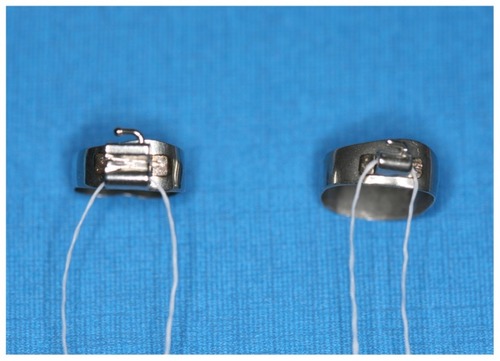 Figure 2 Prefabricated bands prior to placement in the mouth being secured with an adequate length of floss as a precaution.