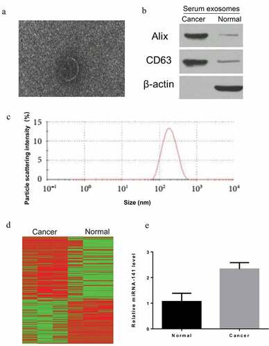 Figure 1. Extraction and identification of serum exosomes