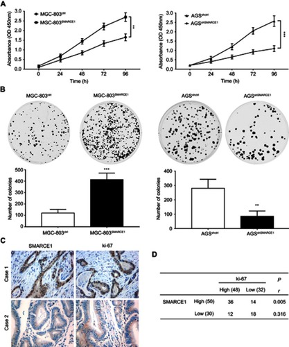 Figure 4 SMARCE1 promotes GC cell proliferation in vitro.Notes: (A) GC cell viability was assessed using the CCK-8 assay after transfection with SMARCE1, shSMARCE1, or control lentiviruses. (B) The proliferative capacity was evaluated through a colony formation assay and quantitative data of the colony number are shown. (C) Representative images of SMARCE1 and ki-67 IHC staining in 80 human GC tissues. Magnification ×400; (D) Correlation analysis revealed a strong correlation between SMARCE1 and ki-67 in GC tissues. The data are shown as the mean ± SD of three independent experiments. **P<0.01; ***P<0.001.Abbreviations: OD, optical density; GC, gastric cancer; CCK-8, Cell Counting Kit-8 .