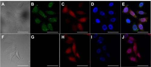 Figure 6 Confocal laser scanning microscopic images of HeLa cells incubated for 4 hours with enhanced green fluorescent protein-loaded nanoparticles. The scale bars correspond to 20 μm in all images. (A and F) Transmittance image, (B and G) fluorescein isothiocyanate-bovine serum albumin (green), (C and H) lysosome stained with lysoTracker® red (red), and (D and I) 4′,6-diamidino-2-phenylindole (DAPI, blue). (E) Overlays of B, C, and D. (J) Overlays of G, H, and I.
