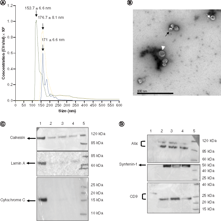 Figure 1. Characterization of exosome-enriched samples derived from HEK293T cells. (A) Size and concentration profile, as analysed by nanoparticle tracking analysis, showing three peaks with a modal size of 153.7 ± 6.6 nm, 176.7 ± 8.1 nm and 171 ± 6.6 nm (n = 3). (B) Image taken by transmission electron microscopy (120 kV) showing exosome-like vesicles of ∼50 nm diameter (white arrow head), exosome-like vesicles of ∼40 nm diameter (white arrow) and exosome-like vesicles with a diameter of ∼30 nm (black arrows). Scale bar: 500 nm. (C & D) Show western blotting images of the protein expression levels for negative control markers (CALNEXIN, LAMIN-A and CYTOCHROME-C) at ∼90, ∼69 and ∼12 kDa, respectively, and the exosomal markers (ALIX, SYNTENIN-1 and CD9) at ∼97, ∼35 and ∼25 kDa, respectively. Lane 1 corresponds to HEK293T cell lysates, lane 2–4 correspond to exosome samples (n = 3) and lane 5 corresponds to the protein marker. The density of protein bands was identified and manually selected for quantification on chemiluminescent blots using GBOX Chemi XX6/XX9 equipped with GeneTools software, by normalizing the relative protein amount in each lane against the band intensities obtained from HEK293 T cell lysates. Strong bands can be seen for CYTOCHROME-C and LAMIN-A in HEK293T cell lysate (lane 1), while no bands are present in the exosome samples shown in lanes 2, 3 and 4. CALNEXIN expression can be seen as fainter bands in the exosome lysates (lanes 2, 3 and 4) with a mean band density that is 0.36-times lower when compared with the HEK293T cell lysate (lane 1). With regard to the exosomal markers, no bands are visible for ALIX and SYNTENIN-1 in the HEK293T cell lysates shown in lane 1, and stronger bands can be seen for exosome lysates (lanes 2, 3 and 4). CD9 was clearly evident in lane 1; the mean band density for this protein marker in the exosome lysates (lanes 2, 3 and 4) was 0.20-times higher than in the HEK293T cell lysates.