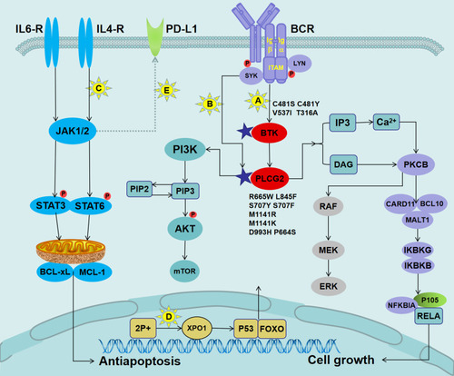 Figure 2 Mechanisms of ibrutinib resistance in CLL and mutations in pathways governing BCR signaling.Notes: (A) The BTK mutation attenuated its binding to ibrutinib, resulting in a reduced ability to inhibit the phosphorylation of downstream molecules, thereby allowing the BCR signal to continue to be passed down. (B) LYN and SYK kinase bypassed BTK to directly activate the mutant PLCG2, which caused increased Ca2+ influx to activate different oncogenic pathways, including PIK3–Akt, NF-κB survival signaling, and the MAP kinase pathway. (C) The binding of IL-4 and IL-6 released from the microenvironment to their corresponding receptors activated JAK kinase, followed by the phosphorylation of the STAT6 or STAT3. The activated STAT upregulated the expression levels of anti-apoptotic proteins MCL-1 and BCL-xL. (D) The acquired short arm of chromosome 2 (2p+) induced the overexpression of XPO1. XPO1 promoted the export of tumor suppressor proteins (such as p53 and FOXO) to the cytoplasm, thereby relieving their inhibitory effect on the cell cycle. (E) Activation of the JAK/STAT signaling pathways might lead to overexpression of PD-L1/PD-L2 in patients with RT.Abbreviations: IL-4, interleukin 4; JAK, Janus kinase; STAT6, signal transducer and activator of transcription factor 6; MCL-1, myeloid cell leukemia-1; BCL-xL, B-cell lymphoma-xL; XPO1, exportin-1.