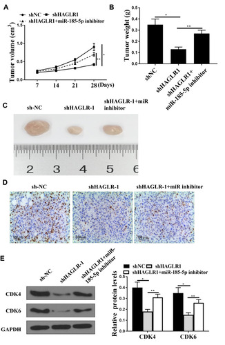 Figure 6 Downregulation of HAGLR1 inhibited the progression of colon cancer in vivo. (A) Measurement of tumor volume in nude mice weekly. (B) Comparison of tumor weight in nude mice. (C) Representative images of three groups of subcutaneous tumors. (D) Ki-67 staining. (E) Protein expression levels of CDK4 and CDK6 was used to detect by Western blot. * P <0.05, ** p <0.01, n = 5.