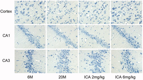Figure 2. ICA effectively improves the condition of neurons (400×). Nissl body is mainly distributed in the cytoplasm of neurons except axons, and its main function is to synthesize protein. Compared with 6 M, the staining of Nissl bodies in cortex and hippocampus of 20 M rat became lighter, which suggesting the neuronal function is impaired. ICA significantly reversed the trend in a dose-dependent manner.