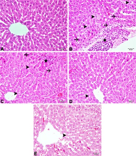 Figure 3. Photomicrography of liver sections. A (Sham group): Normal histological appearance, B (Sepsis group): Severe inflammation in the serosa, mononuclear cell infiltration (star), necrosis (arrows) and degeneration (arrowheads) in hepatocytes, C (OSJ 150 group): Moderate mononuclear cell infiltration (star), degeneration (arrowheads) and necrosis (arrows) in hepatocytes, D (OSJ 300 group): Mild degeneration of hepatocytes (arrowhead), E (REF group): Mild degeneration of hepatocytes (arrowhead), H&E, Bar: 20µm.