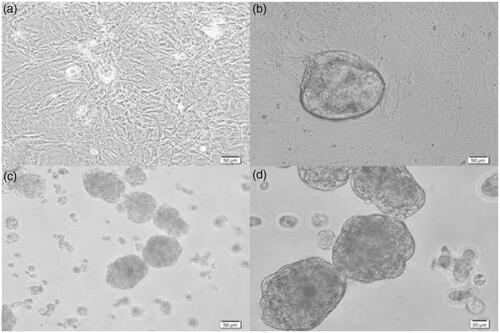 Figure 4. The SSCs colonies in the control, gelatin and SACS groups on day 14 after culture. (a) Control group, (b) gelatin group and (c,d) SACS group. As seen, no colonies were observed in the control group and only single cells and small clusters of SSCs were observed in this group. Magnification: 50 and 20 micrometers.