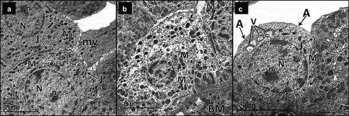 Figure 12. Electron micrographs of sections in the collecting tubule of adult male rats in all study groups. a Control group, the collecting tubular cells have regular euchromatic nuclei (n) with prominent nucleoli (n). They have smooth apical membrane away from few short microvilli (mv) and numerous mitochondria (m). The cells are attached to each other by tight junctions (j). b DN group, the collecting tubular cell has rarified cytoplasm (*) and bizarre shaped mitochondria (M) and rests on a thick basement membrane (BM). c DN + ZnO-NPs group, the collecting tubular cells have regular euchromatic nucleus (N) with prominent nucleoli (n). They have smooth apical membranes (a), numerous mitochondria (M) and apparent vacuoles (v). The cells are attached to each other by tight junctions (J).