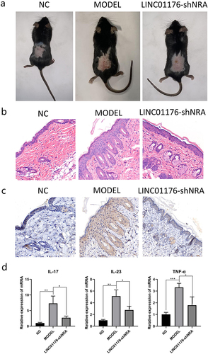 Figure 6 The phenotype and pathology of psoriasis mouse model. (a) Interference with linc01176 has a therapeutic effect on psoriasis model mice. (b) HE staining showed that the extent of lesion repair after interference with LINC01176 approximated that of the NC group, the scale in the figures is 200:1. (c) Immunohistochemical results showed that IL-36G expression after interference with LINC01176 approximated that of the NC group, the scale in the figures is 200:1. (d) qPCR results showed that interference with LINC01176 decreased the gene expression levels of inflammatory factors IL-17, IL-23, and TNF-α in a mouse model of psoriasis (*P < 0.05, **P < 0.01, ***P < 0.001.).