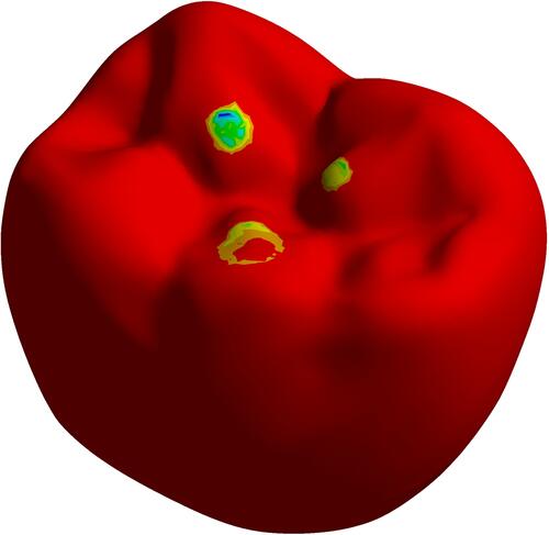 Figure 5 The three points of indenter contacting the occlusal surface.